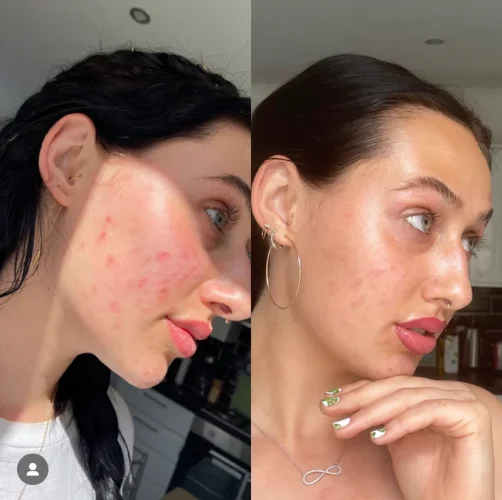 Nibu Pleťové sérum Glow Darker s astaxantínom